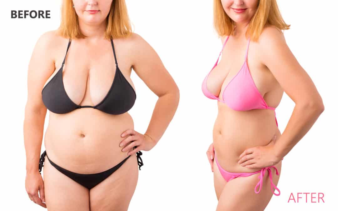 Semaglutide – Before And After Results