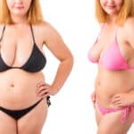 Semaglutide - Before And After Results